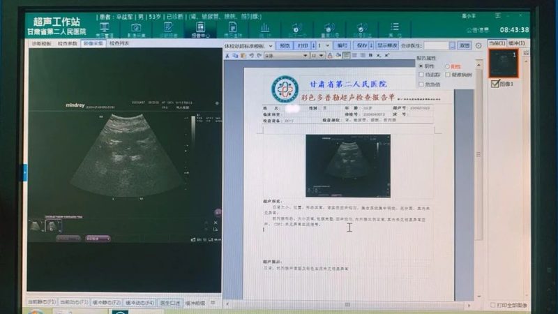 防癌体检项目怎么搭配